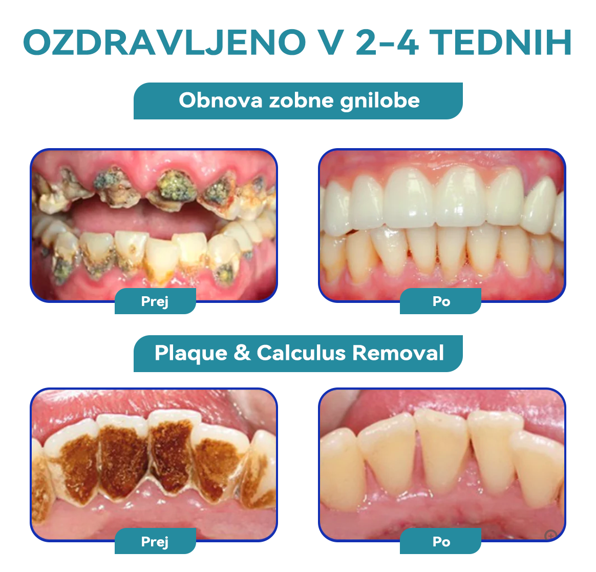 ✨🐝𝐅𝐮𝐫𝐳𝐞𝐫𝐨™ 𝐍𝐚𝐬𝐦𝐞𝐡 𝐳𝐝𝐫𝐚𝐯𝐣𝐞 Č𝐞𝐛𝐞𝐥𝐣𝐢 𝐬𝐭𝐫𝐮𝐩 𝐙𝐝𝐫𝐚𝐯𝐥𝐣𝐞𝐧𝐣𝐞 𝐔𝐬𝐭𝐧𝐨 𝐏𝐫𝐚š𝐞𝐤