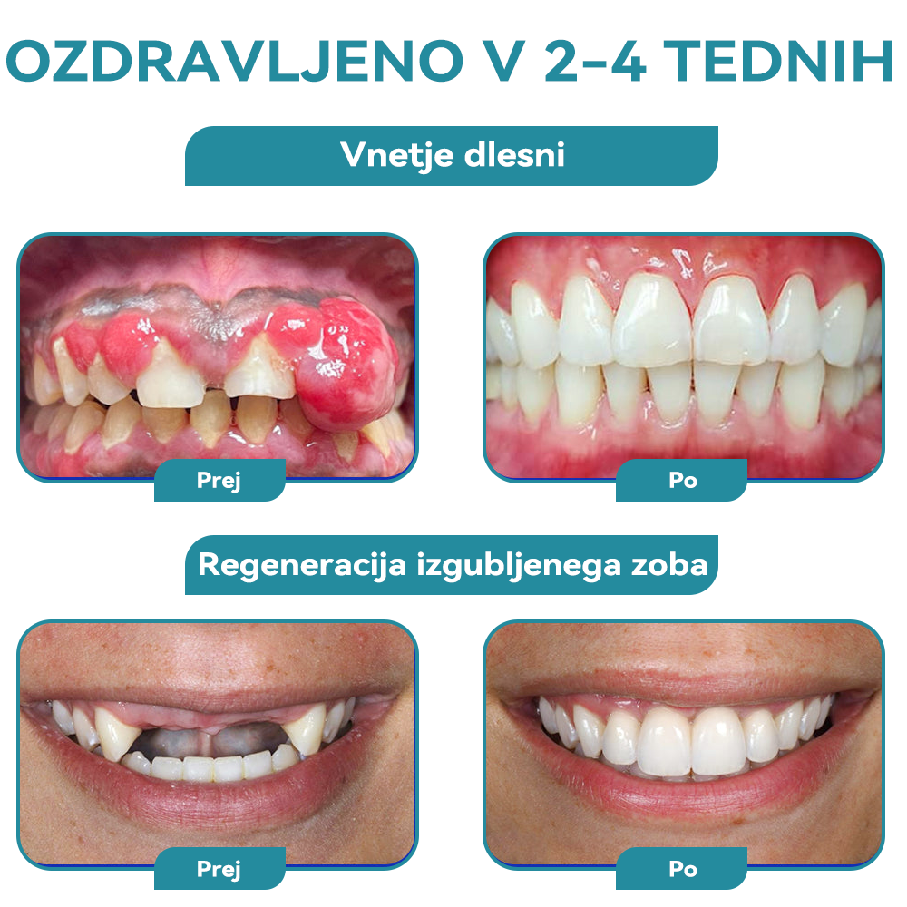 ✨🐝𝐅𝐮𝐫𝐳𝐞𝐫𝐨™ 𝐍𝐚𝐬𝐦𝐞𝐡 𝐳𝐝𝐫𝐚𝐯𝐣𝐞 Č𝐞𝐛𝐞𝐥𝐣𝐢 𝐬𝐭𝐫𝐮𝐩 𝐙𝐝𝐫𝐚𝐯𝐥𝐣𝐞𝐧𝐣𝐞 𝐔𝐬𝐭𝐧𝐨 𝐏𝐫𝐚š𝐞𝐤
