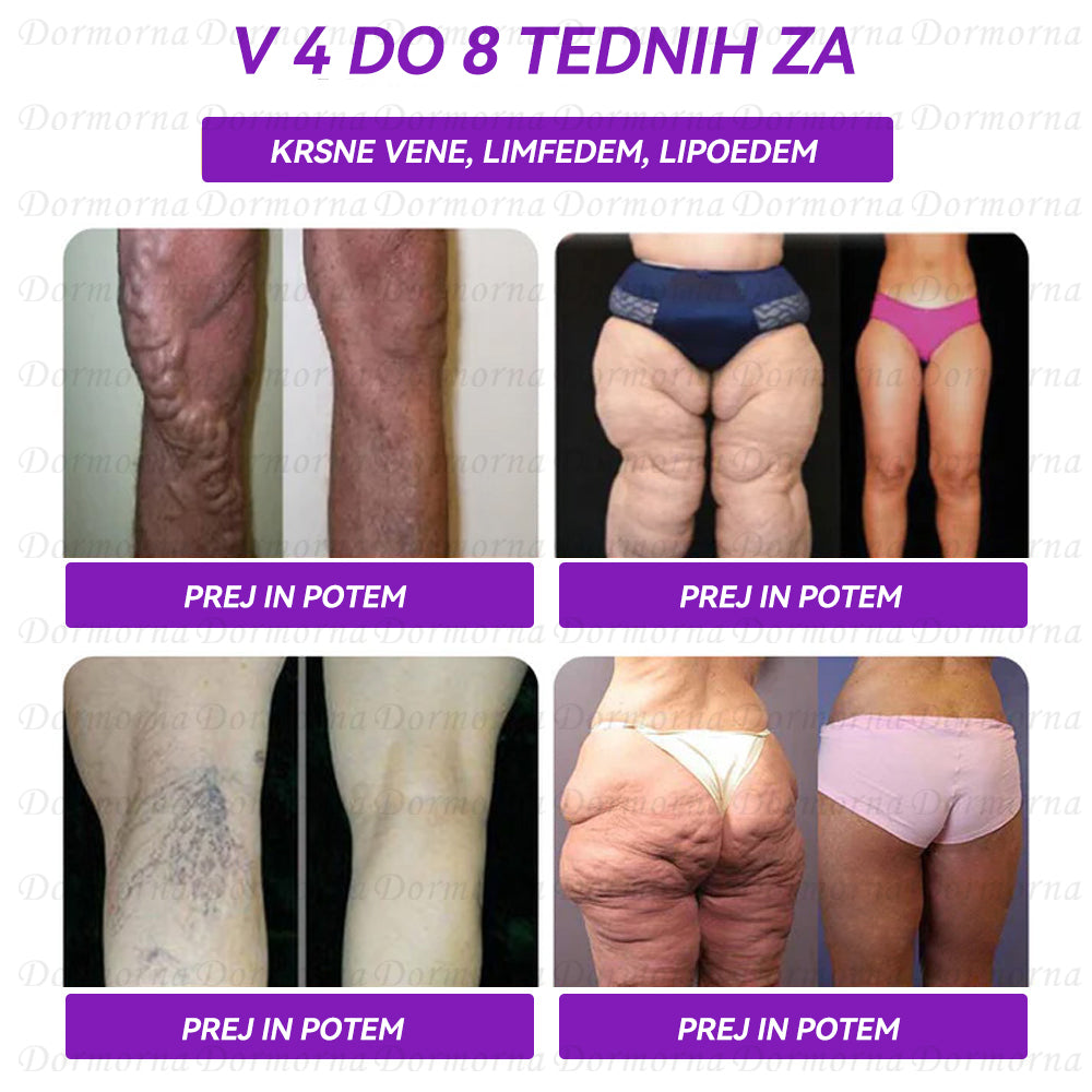 Univerza v Ljubljani, Medicinska fakulteta Priporočamo | Uradna trgovina | 𝐃𝐨𝐫𝐦𝐨𝐫𝐧𝐚® 🦋𝐆𝐋𝐏-𝟏 𝐏𝐞𝐫𝐨𝐫𝐚𝐥𝐧𝐚 𝐓𝐞𝐤𝐨č𝐢𝐧𝐚--✅Revolucionarni GLP-1 znanstveni programi za nadzor sladkorja in hujšanje
