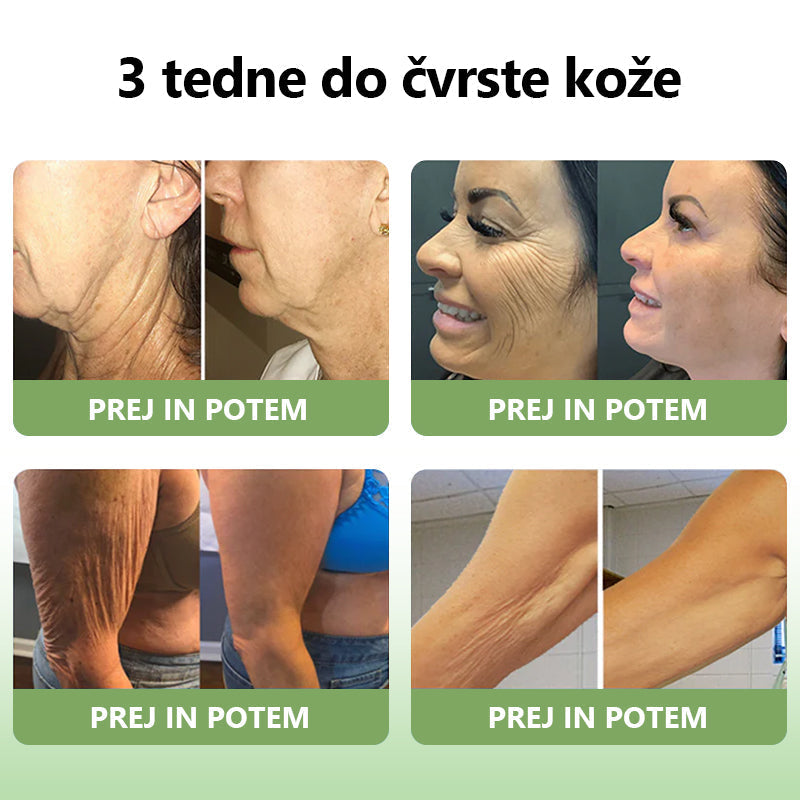 ✅Uradna trgovina: STDEI™📦 𝐋𝐮𝐤𝐬𝐮𝐳𝐧𝐢 𝐤𝐨𝐥𝐚𝐠𝐞𝐧𝐔č𝐯𝐫𝐬𝐭𝐢𝐭𝐯𝐞𝐧𝐚 𝐤𝐫𝐞𝐦𝐚 (🔥74 % popusta za omejen čas!) 📦