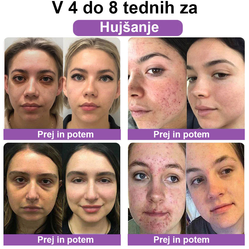 🦄𝐂𝐯𝐫𝐞𝐨𝐳™ Č𝐞𝐛𝐞𝐥𝐣𝐢 𝐬𝐭𝐫𝐮𝐩 𝐍𝐀𝐃+ 𝐍𝐚𝐭𝐮𝐫𝐚𝐥 𝐎𝐛𝐧𝐨𝐯𝐢𝐭𝐯𝐞𝐧𝐞 𝐯𝐚𝐠𝐢𝐧𝐚𝐥𝐧𝐞 𝐤𝐚𝐩𝐬𝐮𝐥𝐞 (Kapsule za zdravje žensk in zdravje kože)