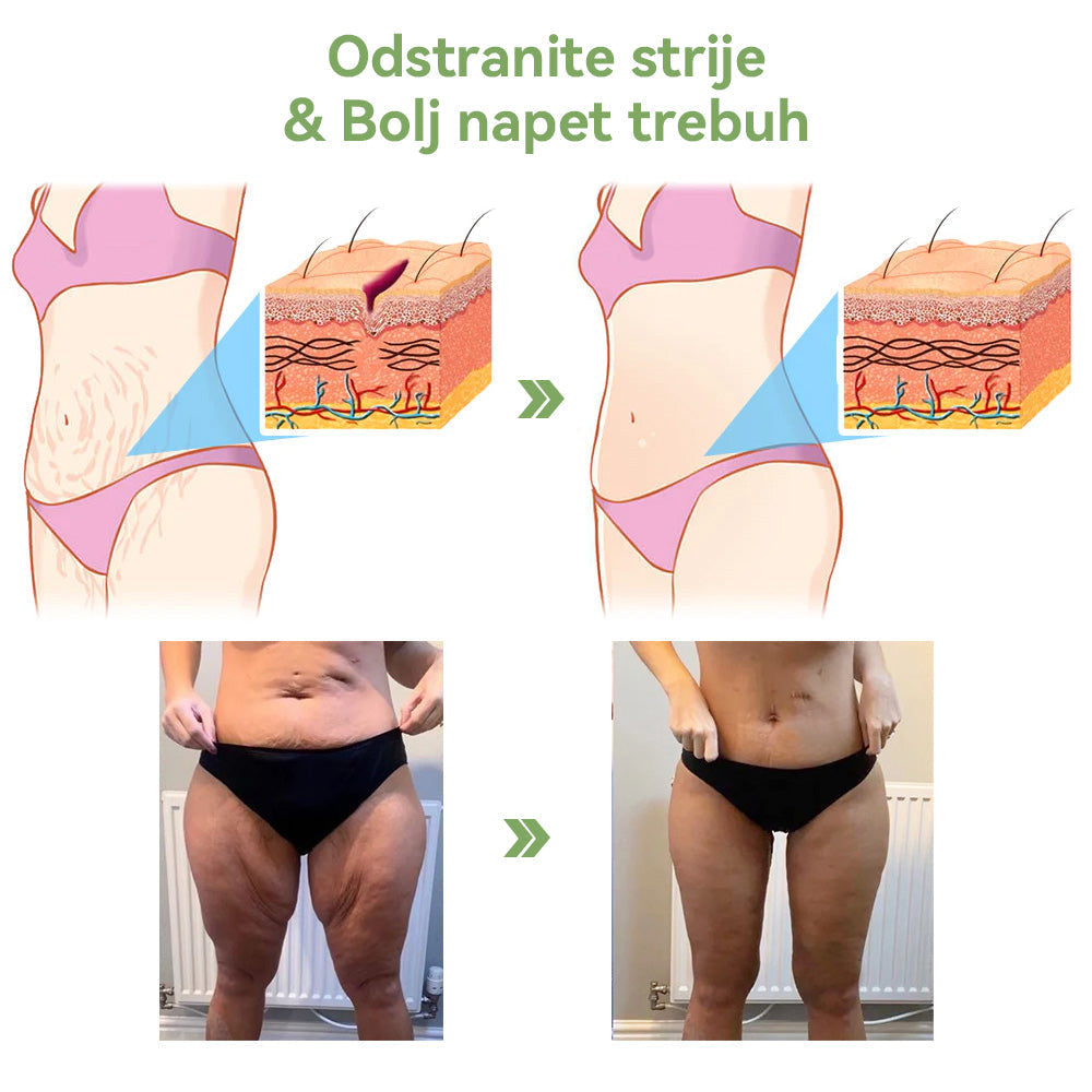 ✅Uradna trgovina: STDEI™📦 𝐋𝐮𝐤𝐬𝐮𝐳𝐧𝐢 𝐤𝐨𝐥𝐚𝐠𝐞𝐧𝐔č𝐯𝐫𝐬𝐭𝐢𝐭𝐯𝐞𝐧𝐚 𝐤𝐫𝐞𝐦𝐚 (🔥74 % popusta za omejen čas!) 📦