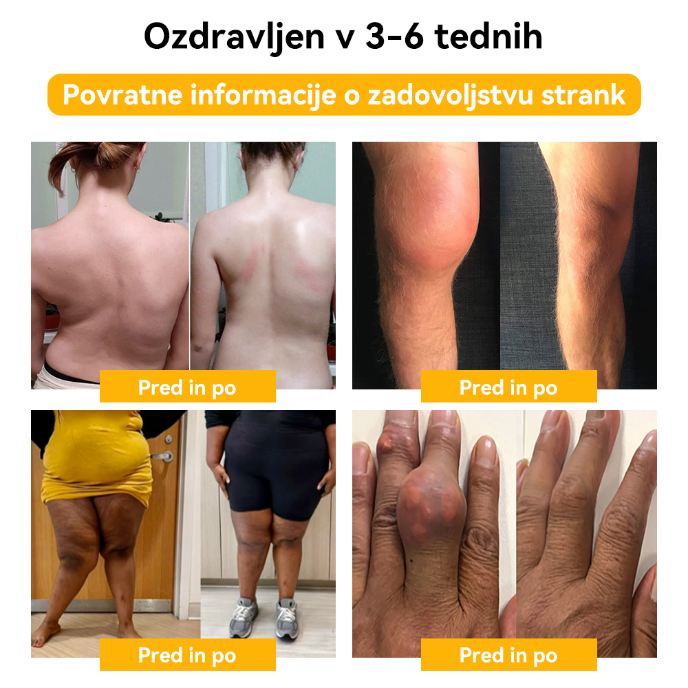 🐳𝐒𝐩𝐳𝐯™ Č𝐞𝐛𝐞𝐥𝐣𝐢 𝐒𝐭𝐫𝐮𝐩 𝐒𝐤𝐥𝐞𝐩𝐢 & 𝐊𝐨𝐬𝐭𝐢 𝐙𝐝𝐫𝐚𝐯𝐥𝐣𝐞𝐧𝐣𝐞 𝐊𝐫𝐞𝐦𝐚 🐝(𝐢𝐳𝐯𝐥𝐞č𝐞𝐤 𝐧𝐨𝐯𝐨𝐳𝐞𝐥𝐚𝐧𝐝𝐬𝐤𝐢𝐡 č𝐞𝐛𝐞𝐥 𝐣𝐞 𝐬𝐩𝐞𝐜𝐢𝐚𝐥𝐢𝐳𝐢𝐫𝐚𝐧 𝐳𝐚 𝐨𝐫𝐭𝐨𝐩𝐞𝐝𝐬𝐤𝐞 𝐛𝐨𝐥𝐞𝐳𝐧𝐢 𝐢𝐧 𝐛𝐨𝐥𝐞č𝐢𝐧𝐞 𝐩𝐫𝐢 𝐚𝐫𝐭𝐫𝐢𝐭𝐢𝐬𝐮)
