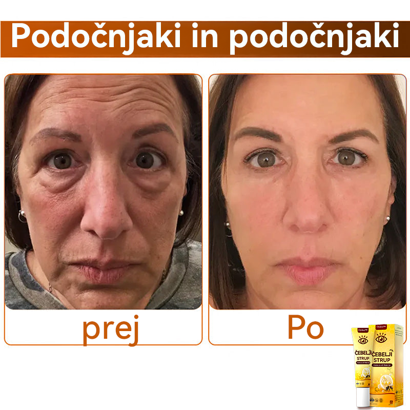 Oyikey™💥💥Čebelji strup Krema za oči Wake Up Priporoča dermatolog.