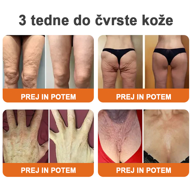 🔮Flysmus™ Botox serum za učvrstitev čebeljega strupa🔥ZADNJI DAN 70 % CENEJE