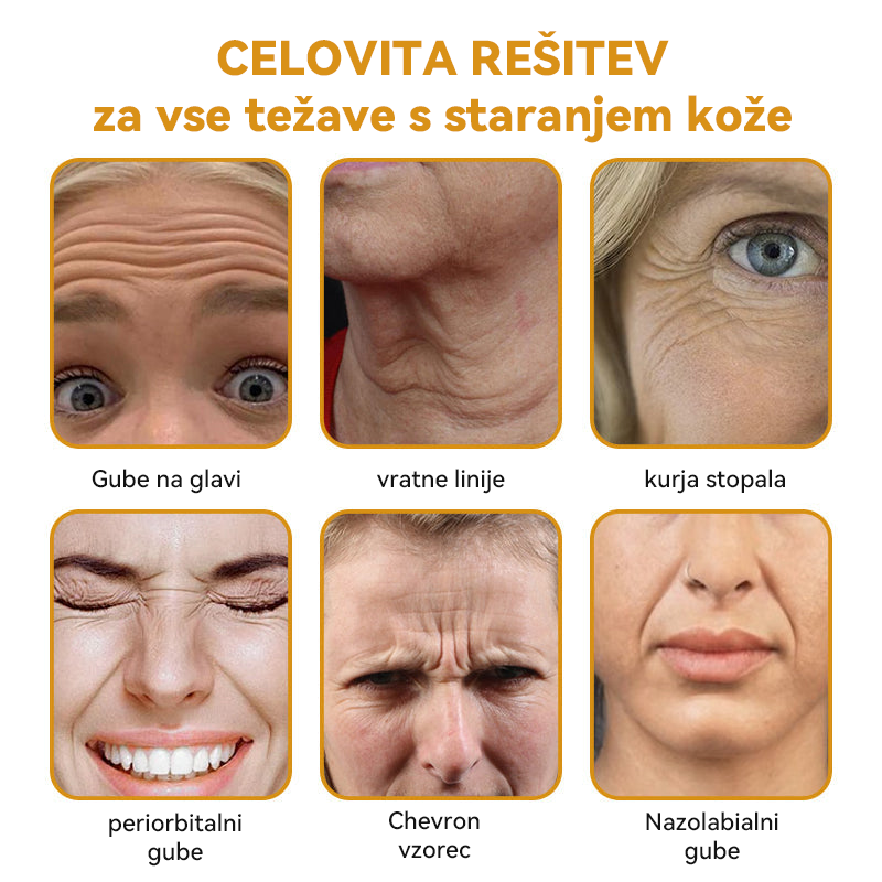 (🎁 Ekskluzivna posebna ponudba - 70 % popust - ne zamudite!) Spzv™💎 𝐁𝐎𝐓𝐎𝐗 Strije proti staranju z medenim strupom