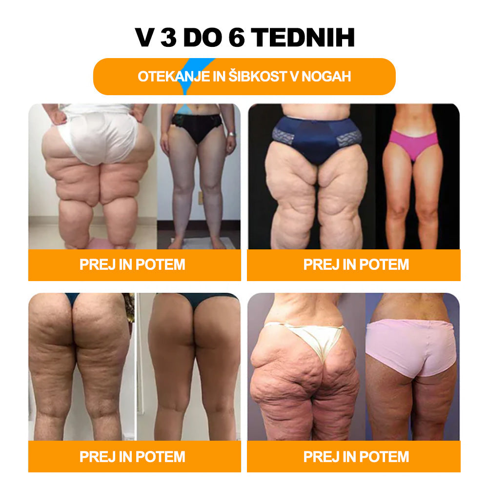 🚚📦Zadnji dan, da bi dobili 70% OFF: Tnnedey® 𝑽č𝒆𝒍í 𝒋𝒆𝒅 𝒂 30 𝒃𝒚𝒍𝒊𝒏𝒏é 𝒅𝒆𝒕𝒐𝒙𝒊𝒌𝒂č𝒏é 𝒈𝒖ľôč𝒌𝒚 𝒏𝒂 𝒌ú𝒑𝒆ľ 𝒏ô𝒉 𝒑𝒓𝒆 𝒕𝒗𝒂𝒓𝒐𝒗𝒂𝒏𝒊𝒆 𝒕𝒆𝒍𝒂- Priporoča Ameriška limfna akademija (ALA)🧀