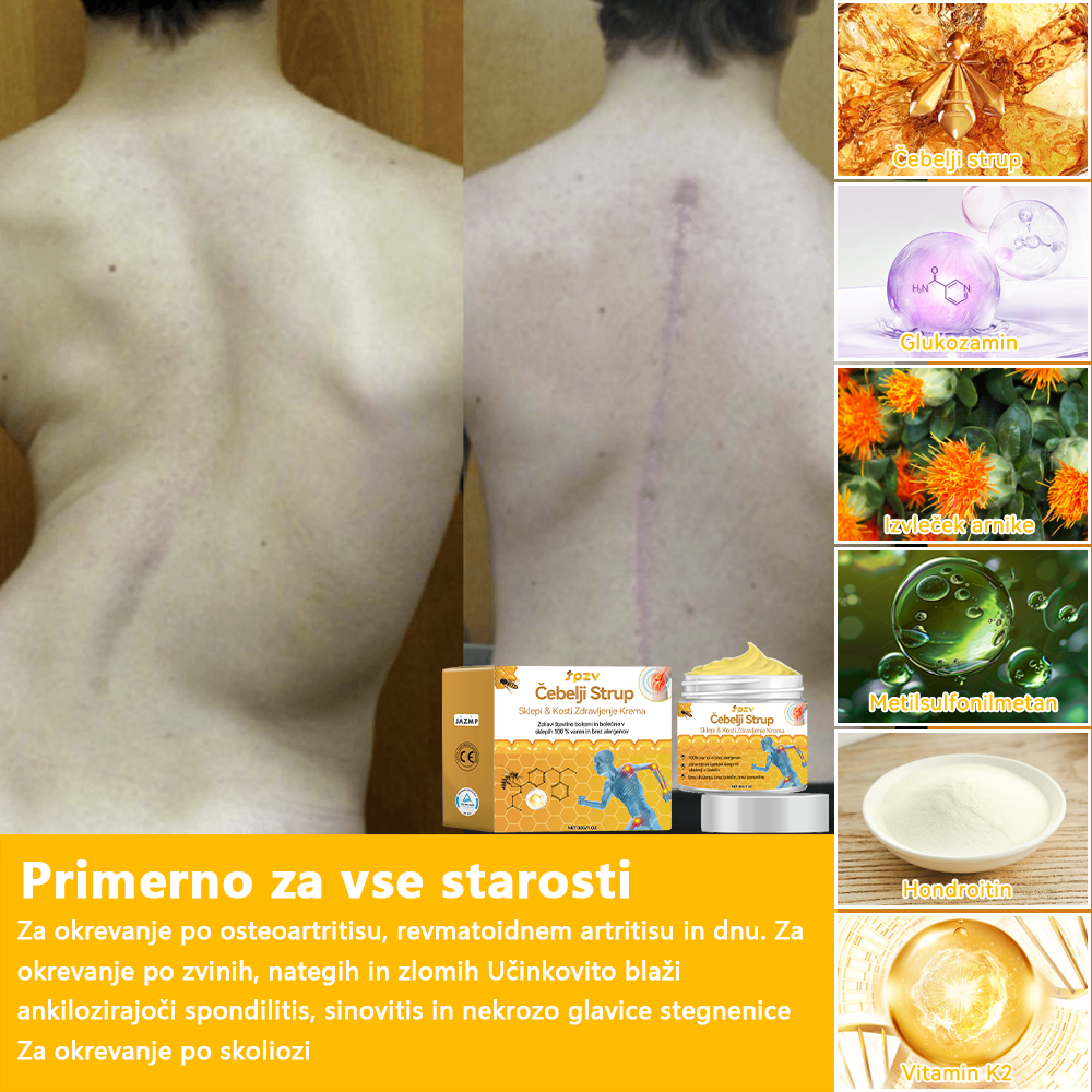 🐳𝐒𝐩𝐳𝐯™ Č𝐞𝐛𝐞𝐥𝐣𝐢 𝐒𝐭𝐫𝐮𝐩 𝐒𝐤𝐥𝐞𝐩𝐢 & 𝐊𝐨𝐬𝐭𝐢 𝐙𝐝𝐫𝐚𝐯𝐥𝐣𝐞𝐧𝐣𝐞 𝐊𝐫𝐞𝐦𝐚 🐝(𝐢𝐳𝐯𝐥𝐞č𝐞𝐤 𝐧𝐨𝐯𝐨𝐳𝐞𝐥𝐚𝐧𝐝𝐬𝐤𝐢𝐡 č𝐞𝐛𝐞𝐥 𝐣𝐞 𝐬𝐩𝐞𝐜𝐢𝐚𝐥𝐢𝐳𝐢𝐫𝐚𝐧 𝐳𝐚 𝐨𝐫𝐭𝐨𝐩𝐞𝐝𝐬𝐤𝐞 𝐛𝐨𝐥𝐞𝐳𝐧𝐢 𝐢𝐧 𝐛𝐨𝐥𝐞č𝐢𝐧𝐞 𝐩𝐫𝐢 𝐚𝐫𝐭𝐫𝐢𝐭𝐢𝐬𝐮)