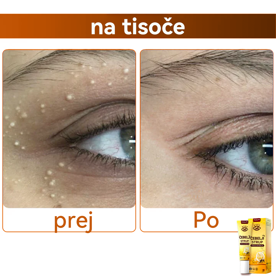 Oyikey™💥💥Čebelji strup Krema za oči Wake Up Priporoča dermatolog.