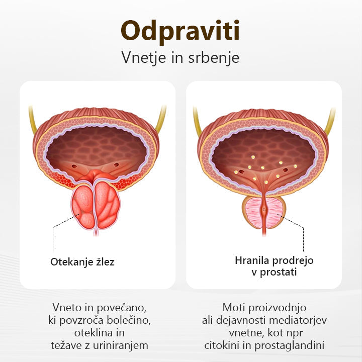 Poslovite se od težav s prostato💎𝐋𝐄𝐅𝐔𝐍𝐓™ 𝐢𝐧𝐡𝐚𝐥𝐚𝐜𝐢𝐣𝐬𝐤𝐚 𝐩𝐚𝐥𝐢𝐜𝐚 𝐳 𝐦𝐞𝐝𝐨𝐦🍀(Hitro in dolgotrajno delovanje)