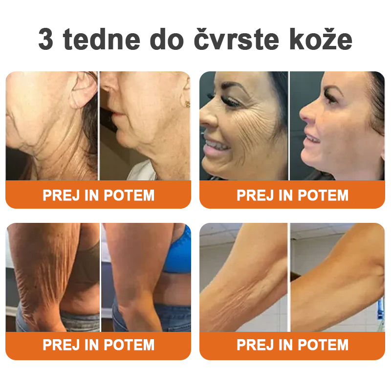 🔮Flysmus™ Botox serum za učvrstitev čebeljega strupa🔥ZADNJI DAN 70 % CENEJE