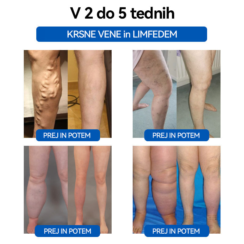 𝐂𝐙𝐓𝐈𝐂𝐋𝐄™ 🦋𝐔𝐥𝐭𝐫𝐚𝐳𝐯𝐨č𝐧𝐨 𝐩𝐞𝐬𝐤𝐚𝐧𝐣𝐞 𝐦𝐚šč𝐨𝐛 𝐃𝐚𝐥𝐞č 𝐢𝐧𝐟𝐫𝐚𝐫𝐝𝐞č𝐞 𝐤𝐫𝐯𝐧𝐢 𝐬𝐥𝐚𝐝𝐤𝐨𝐫 𝐮𝐫𝐚𝐯𝐧𝐨𝐭𝐞ž𝐞𝐧𝐣𝐞 𝐃𝐞𝐭𝐨𝐱 𝐳𝐚𝐩𝐞𝐬𝐭𝐧𝐢𝐜𝐚⏰(🔥🔥Priporočajo plastični kirurgi)