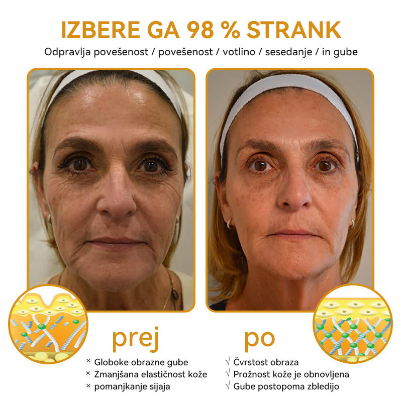 (🎁 Ekskluzivna posebna ponudba - 70 % popust - ne zamudite!) Spzv™💎 𝐁𝐎𝐓𝐎𝐗 Strije proti staranju z medenim strupom