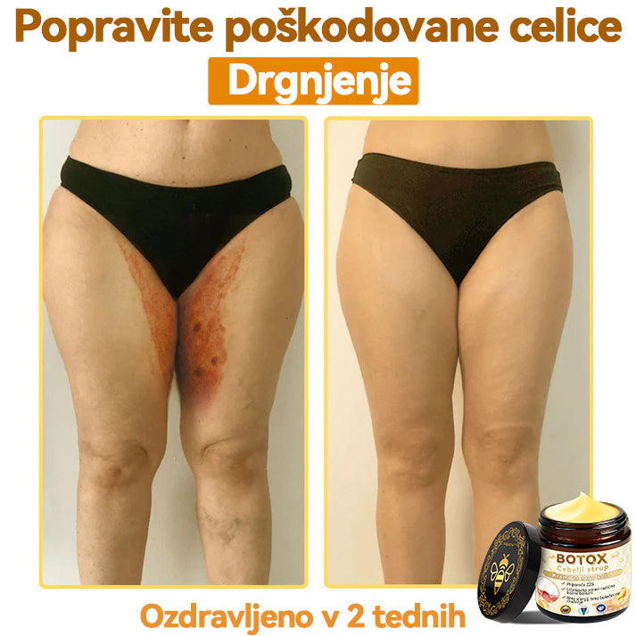 Uradnik klinike Mayo: 🦋𝐒𝐩𝐳𝐯™ 𝐁𝐎𝐓𝐎𝐗 Č𝐞𝐛𝐞𝐥𝐣𝐢 𝐬𝐭𝐫𝐮𝐩 𝐊𝐫𝐞𝐦𝐚 𝐳𝐚 𝐧𝐞𝐠𝐨 𝐤𝐨ž𝐞, Vlaženje, popravilo kože, enakomeren ten, zdravljenje aken in temnih madežev, odstranjevanje bradavic in madežev, lajšanje luskavice