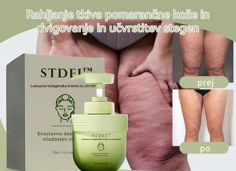 STDEI™ 💧 Luksuzna kolagenska krema za učvrstitev (vrnitev mladostne kože)🌹✨