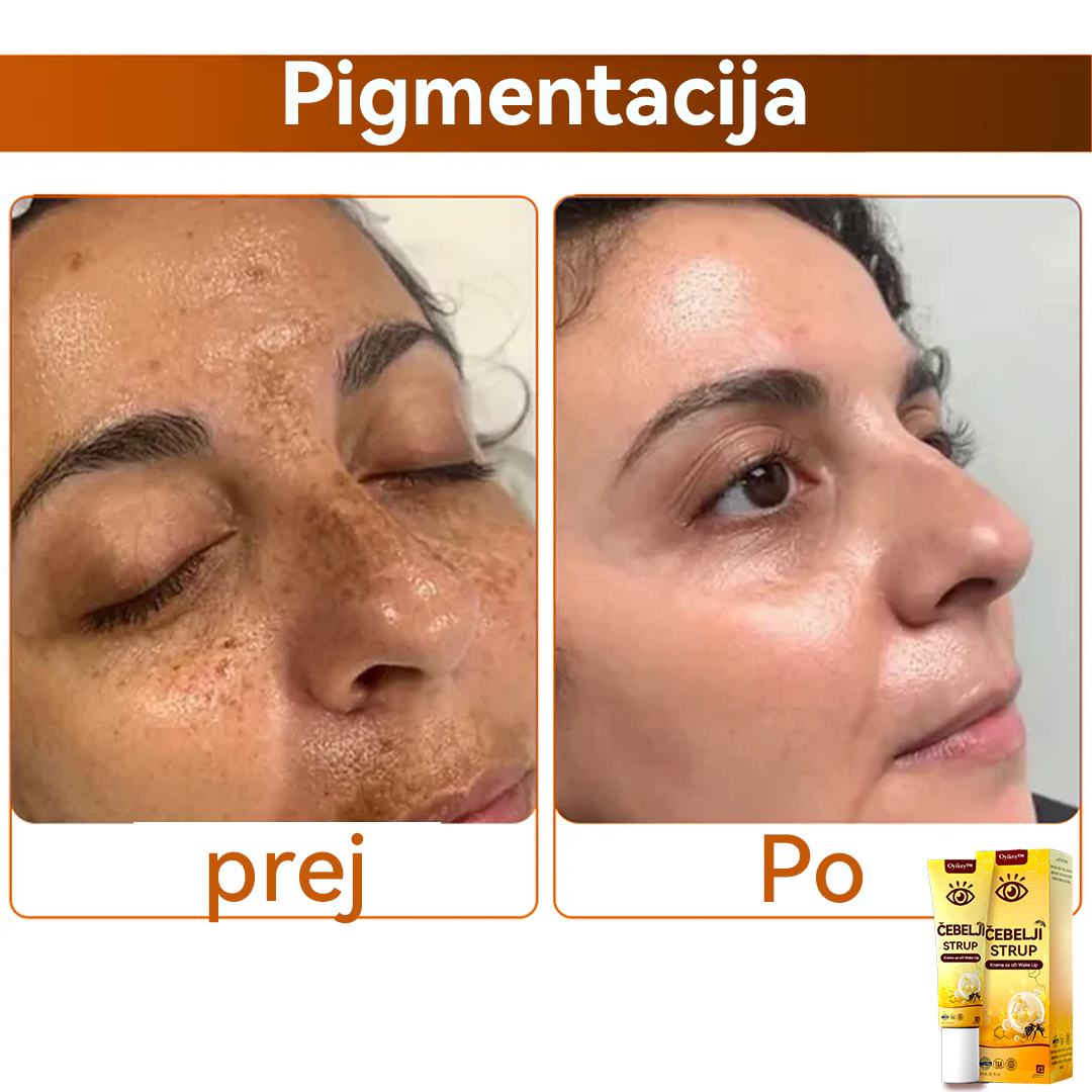 Oyikey™💥💥Čebelji strup Krema za oči Wake Up Priporoča dermatolog.