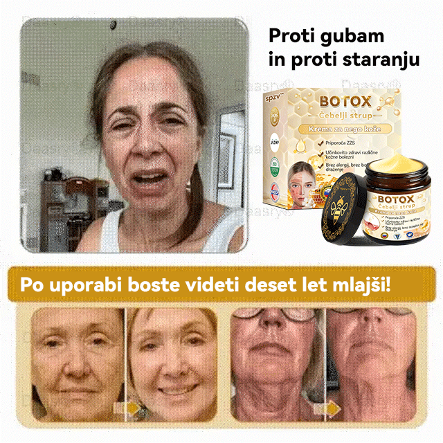 Uradnik klinike Mayo: 🦋𝐒𝐩𝐳𝐯™ 𝐁𝐎𝐓𝐎𝐗 Č𝐞𝐛𝐞𝐥𝐣𝐢 𝐬𝐭𝐫𝐮𝐩 𝐊𝐫𝐞𝐦𝐚 𝐳𝐚 𝐧𝐞𝐠𝐨 𝐤𝐨ž𝐞, Vlaženje, popravilo kože, enakomeren ten, zdravljenje aken in temnih madežev, odstranjevanje bradavic in madežev, lajšanje luskavice