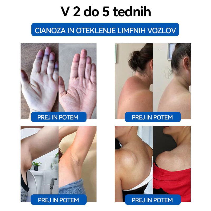 𝐂𝐙𝐓𝐈𝐂𝐋𝐄™ 🦋𝐔𝐥𝐭𝐫𝐚𝐳𝐯𝐨č𝐧𝐨 𝐩𝐞𝐬𝐤𝐚𝐧𝐣𝐞 𝐦𝐚šč𝐨𝐛 𝐃𝐚𝐥𝐞č 𝐢𝐧𝐟𝐫𝐚𝐫𝐝𝐞č𝐞 𝐤𝐫𝐯𝐧𝐢 𝐬𝐥𝐚𝐝𝐤𝐨𝐫 𝐮𝐫𝐚𝐯𝐧𝐨𝐭𝐞ž𝐞𝐧𝐣𝐞 𝐃𝐞𝐭𝐨𝐱 𝐳𝐚𝐩𝐞𝐬𝐭𝐧𝐢𝐜𝐚⏰(🔥🔥Priporočajo plastični kirurgi)