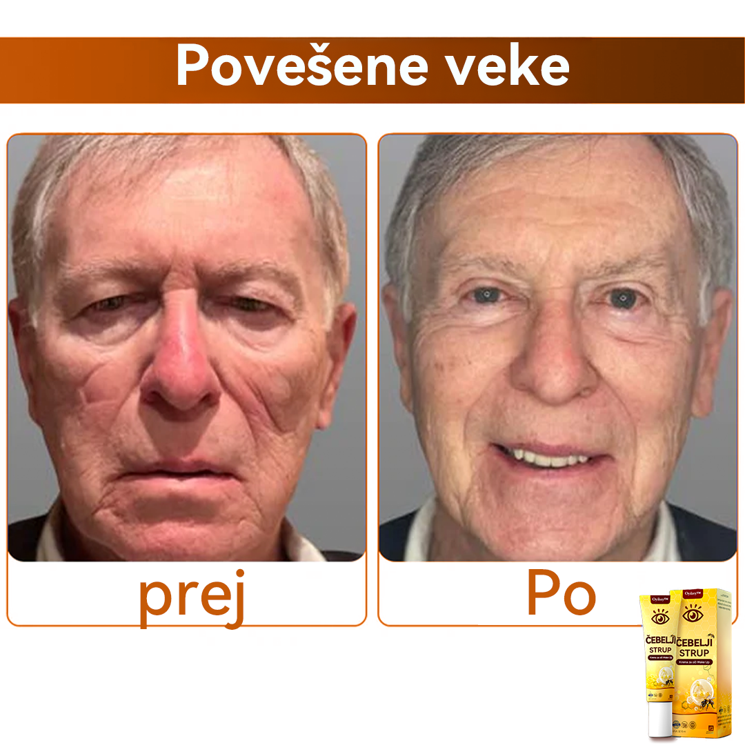 Oyikey™💥💥Čebelji strup Krema za oči Wake Up Priporoča dermatolog.