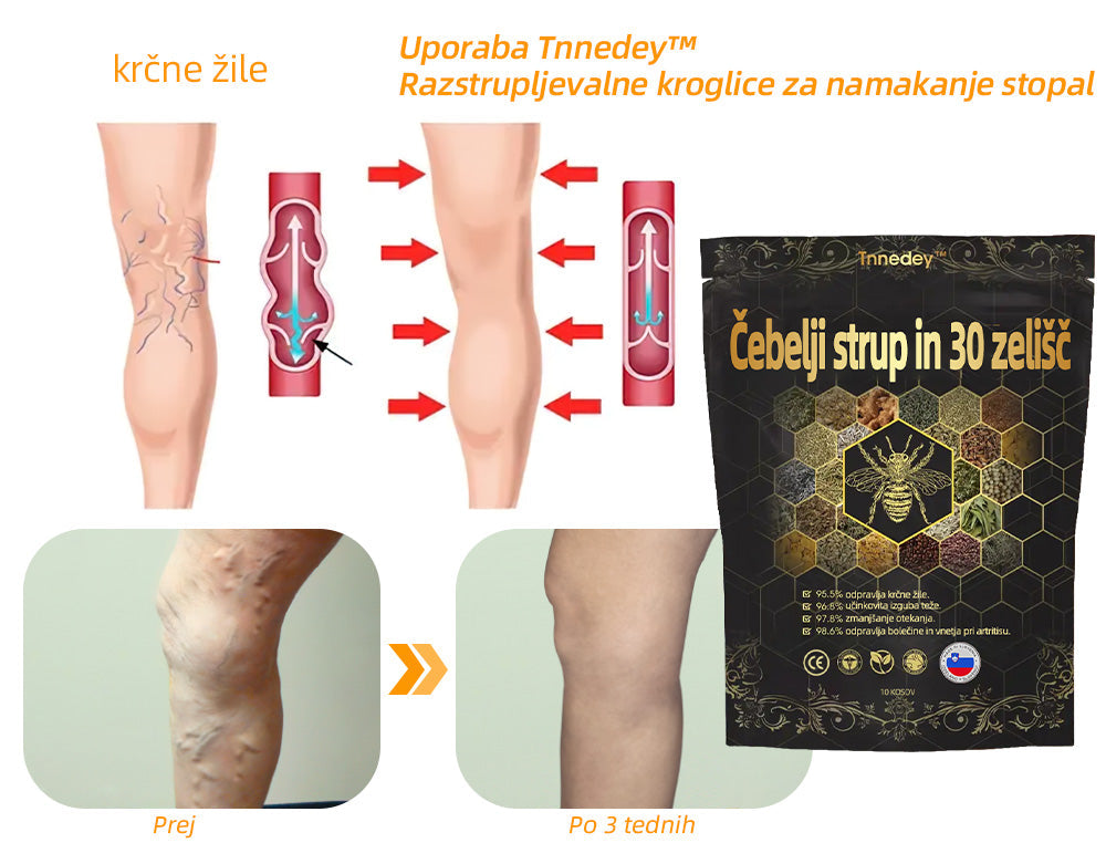 🚚📦Zadnji dan, da bi dobili 70% OFF: Tnnedey® 𝑽č𝒆𝒍í 𝒋𝒆𝒅 𝒂 30 𝒃𝒚𝒍𝒊𝒏𝒏é 𝒅𝒆𝒕𝒐𝒙𝒊𝒌𝒂č𝒏é 𝒈𝒖ľôč𝒌𝒚 𝒏𝒂 𝒌ú𝒑𝒆ľ 𝒏ô𝒉 𝒑𝒓𝒆 𝒕𝒗𝒂𝒓𝒐𝒗𝒂𝒏𝒊𝒆 𝒕𝒆𝒍𝒂- Priporoča Ameriška limfna akademija (ALA)🧀