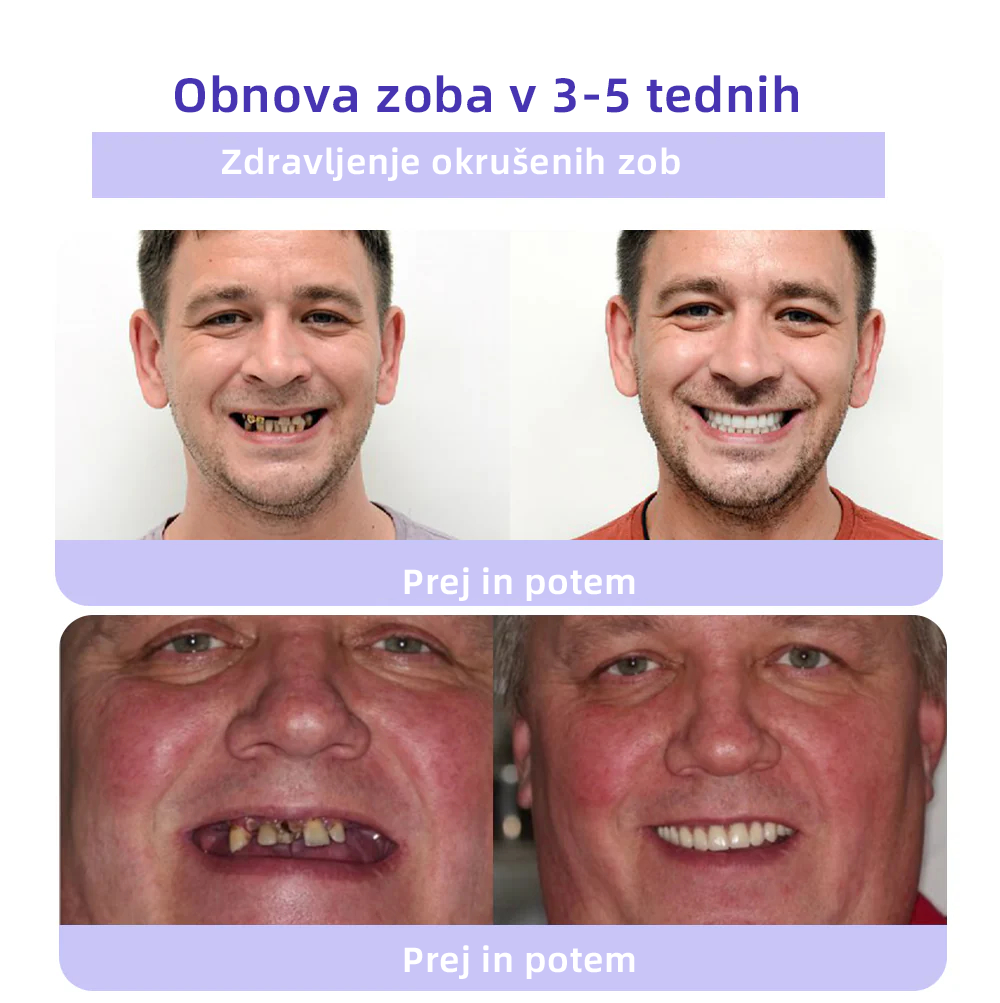 ✅𝐔𝐫𝐚𝐝𝐧𝐚 𝐭𝐫𝐠𝐨𝐯𝐢𝐧𝐚:𝐎𝐲𝐢𝐤𝐞𝐲™ Mineralni prah za obnovo zob 💎 (Priporočeno s strani SDA) (🎁 Časovno omejena akcija - Ne zamudite)