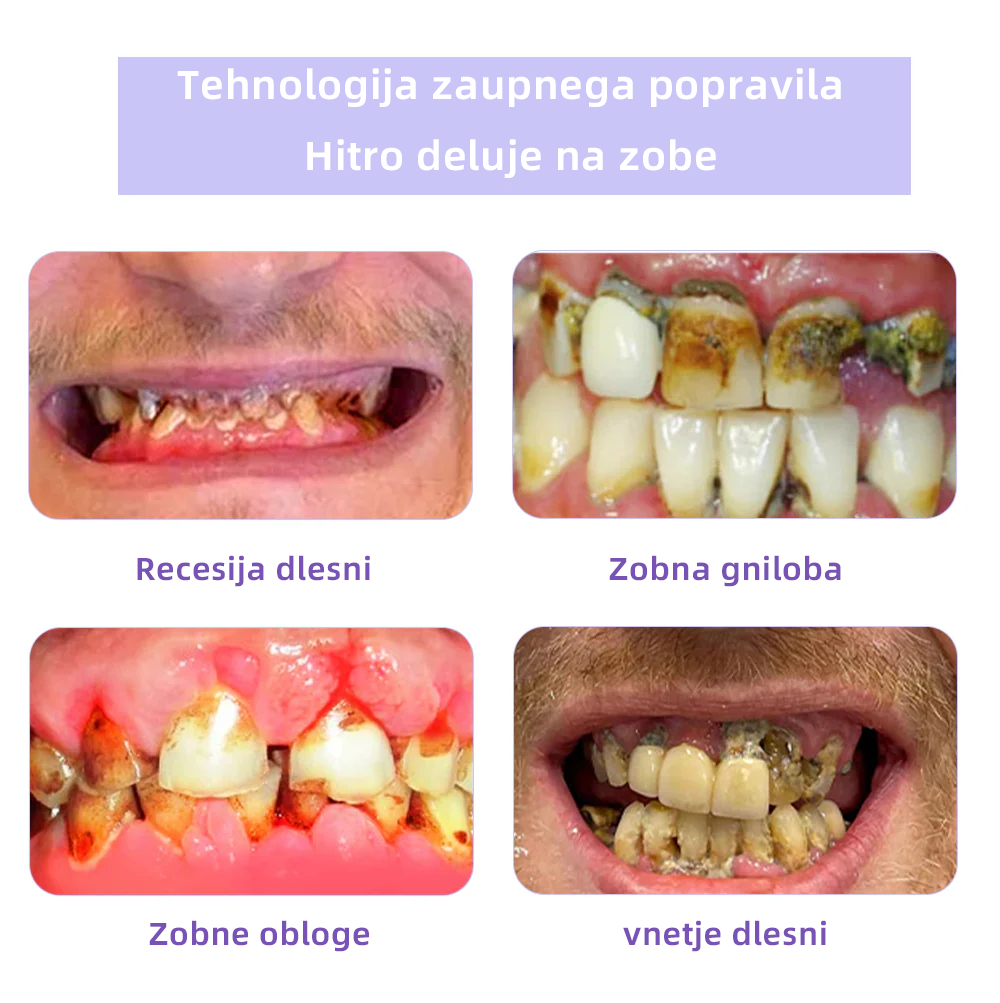 ✅𝐔𝐫𝐚𝐝𝐧𝐚 𝐭𝐫𝐠𝐨𝐯𝐢𝐧𝐚:𝐎𝐲𝐢𝐤𝐞𝐲™ Mineralni prah za obnovo zob 💎 (Priporočeno s strani SDA) (🎁 Časovno omejena akcija - Ne zamudite)