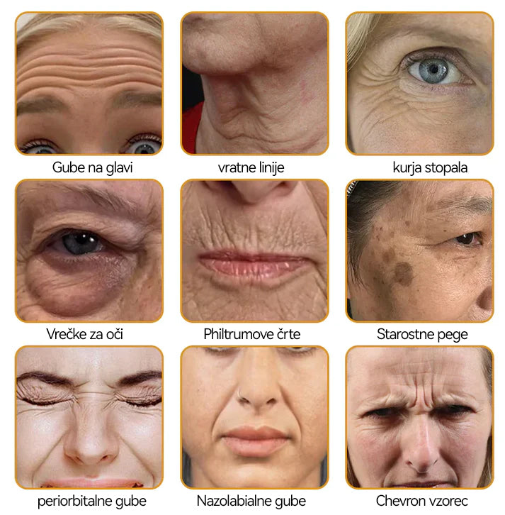 Uradnik klinike Mayo: 🦋𝐒𝐩𝐳𝐯™ 𝐁𝐎𝐓𝐎𝐗 Č𝐞𝐛𝐞𝐥𝐣𝐢 𝐬𝐭𝐫𝐮𝐩 𝐊𝐫𝐞𝐦𝐚 𝐳𝐚 𝐧𝐞𝐠𝐨 𝐤𝐨ž𝐞, Vlaženje, popravilo kože, enakomeren ten, zdravljenje aken in temnih madežev, odstranjevanje bradavic in madežev, lajšanje luskavice