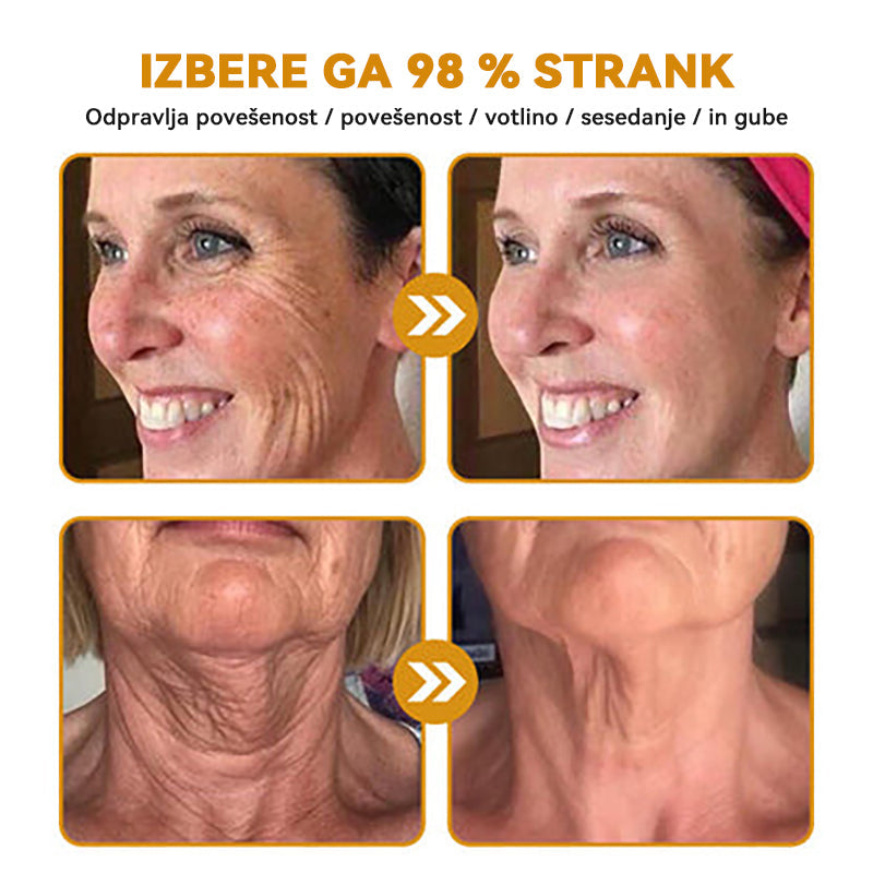 Uradnik klinike Mayo: 🦋𝐒𝐩𝐳𝐯™ 𝐁𝐎𝐓𝐎𝐗 Č𝐞𝐛𝐞𝐥𝐣𝐢 𝐬𝐭𝐫𝐮𝐩 𝐊𝐫𝐞𝐦𝐚 𝐳𝐚 𝐧𝐞𝐠𝐨 𝐤𝐨ž𝐞, Vlaženje, popravilo kože, enakomeren ten, zdravljenje aken in temnih madežev, odstranjevanje bradavic in madežev, lajšanje luskavice
