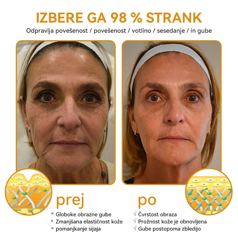 Uradnik klinike Mayo: 🦋𝐒𝐩𝐳𝐯™ 𝐁𝐎𝐓𝐎𝐗 Č𝐞𝐛𝐞𝐥𝐣𝐢 𝐬𝐭𝐫𝐮𝐩 𝐊𝐫𝐞𝐦𝐚 𝐳𝐚 𝐧𝐞𝐠𝐨 𝐤𝐨ž𝐞, Vlaženje, popravilo kože, enakomeren ten, zdravljenje aken in temnih madežev, odstranjevanje bradavic in madežev, lajšanje luskavice