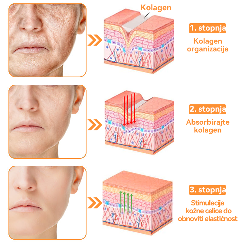 Dormorna™ 💧 Krema za nego kože celotnega telesa (👩‍⚕️priporočeno s strani Inštituta za dermatologijo)