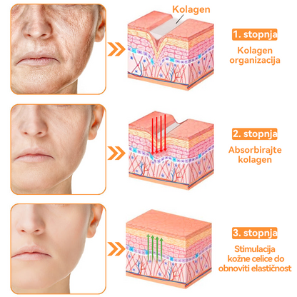 Dormorna™ 💧 Krema za nego kože celotnega telesa (👩‍⚕️priporočeno s strani Inštituta za dermatologijo)