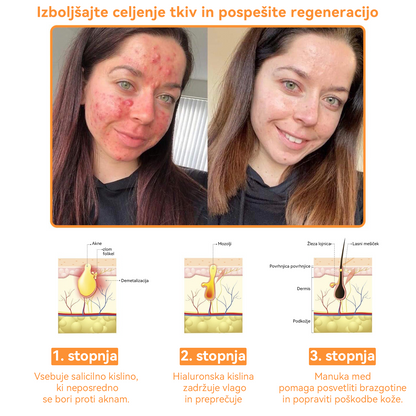 Dormorna™ 💧 Krema za nego kože celotnega telesa (👩‍⚕️priporočeno s strani Inštituta za dermatologijo)