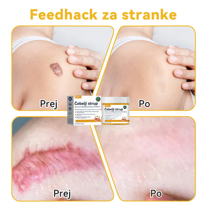 🍍𝑺𝒑𝒛𝒗™  Č𝒆𝒃𝒆𝒍𝒋𝒊 𝒔𝒕𝒓𝒖𝒑 𝑲𝒓𝒆𝒎𝒂 𝒛𝒂 𝒛𝒅𝒓𝒂𝒗𝒍𝒋𝒆𝒏𝒋𝒆 𝒌𝒓𝒆𝒕𝒆𝒏𝒋 𝒊𝒏 𝒃𝒓𝒂𝒅𝒂𝒗𝒊𝒄 ⚡⚡(🧑‍⚕️𝑺𝒑𝒆𝒄𝒊𝒂𝒍𝒊𝒔𝒕 𝑫𝒆𝒓𝒎𝒂𝒕𝒐𝒍𝒐𝒈𝒊𝒔𝒕 𝑹𝒆𝒄𝒐𝒎𝒎𝒆𝒏𝒅𝒂𝒕𝒊𝒐𝒏🔥🔥𝒁𝒂𝒅𝒏𝒋𝒂 𝒑𝒓𝒐𝒎𝒐𝒄𝒊𝒋𝒂 𝒅𝒂𝒍𝒚 80% 𝒐𝒇𝒇)
