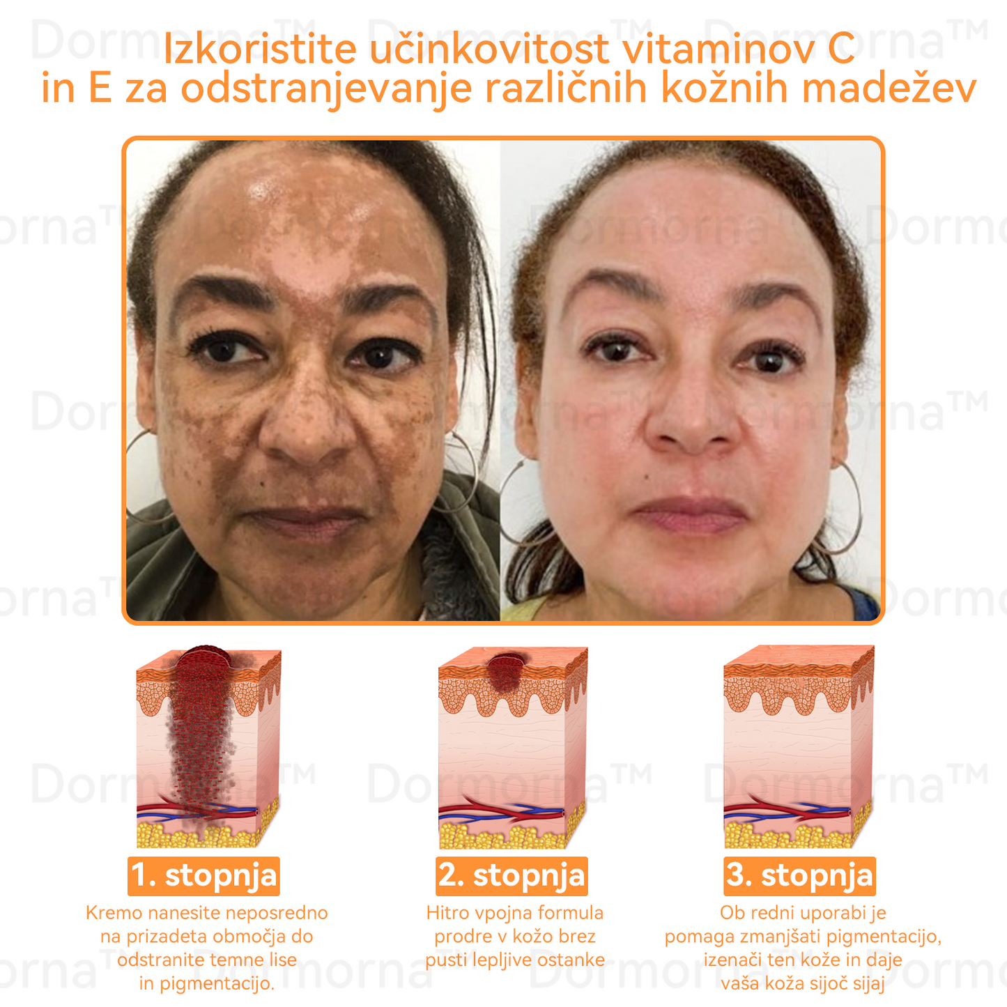✅𝐔𝐫𝐚𝐝𝐧𝐚 𝐭𝐫𝐠𝐨𝐯𝐢𝐧𝐚:𝐷𝑜𝑟𝑚𝑜𝑟𝑛𝑎™💎 č𝑒𝑏𝑒𝑙𝑗𝑖 𝑠𝑡𝑟𝑢𝑝 𝑣𝑠𝑒-𝑣-𝑒𝑛𝑒𝑚 𝑘𝑟𝑒𝑚 (JAZMP pričevanja)👨‍⚕️⭐