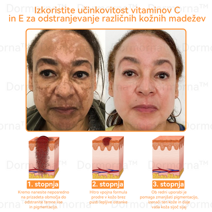 ✅𝐔𝐫𝐚𝐝𝐧𝐚 𝐭𝐫𝐠𝐨𝐯𝐢𝐧𝐚:𝐷𝑜𝑟𝑚𝑜𝑟𝑛𝑎™💎 č𝑒𝑏𝑒𝑙𝑗𝑖 𝑠𝑡𝑟𝑢𝑝 𝑣𝑠𝑒-𝑣-𝑒𝑛𝑒𝑚 𝑘𝑟𝑒𝑚 (JAZMP pričevanja)👨‍⚕️⭐