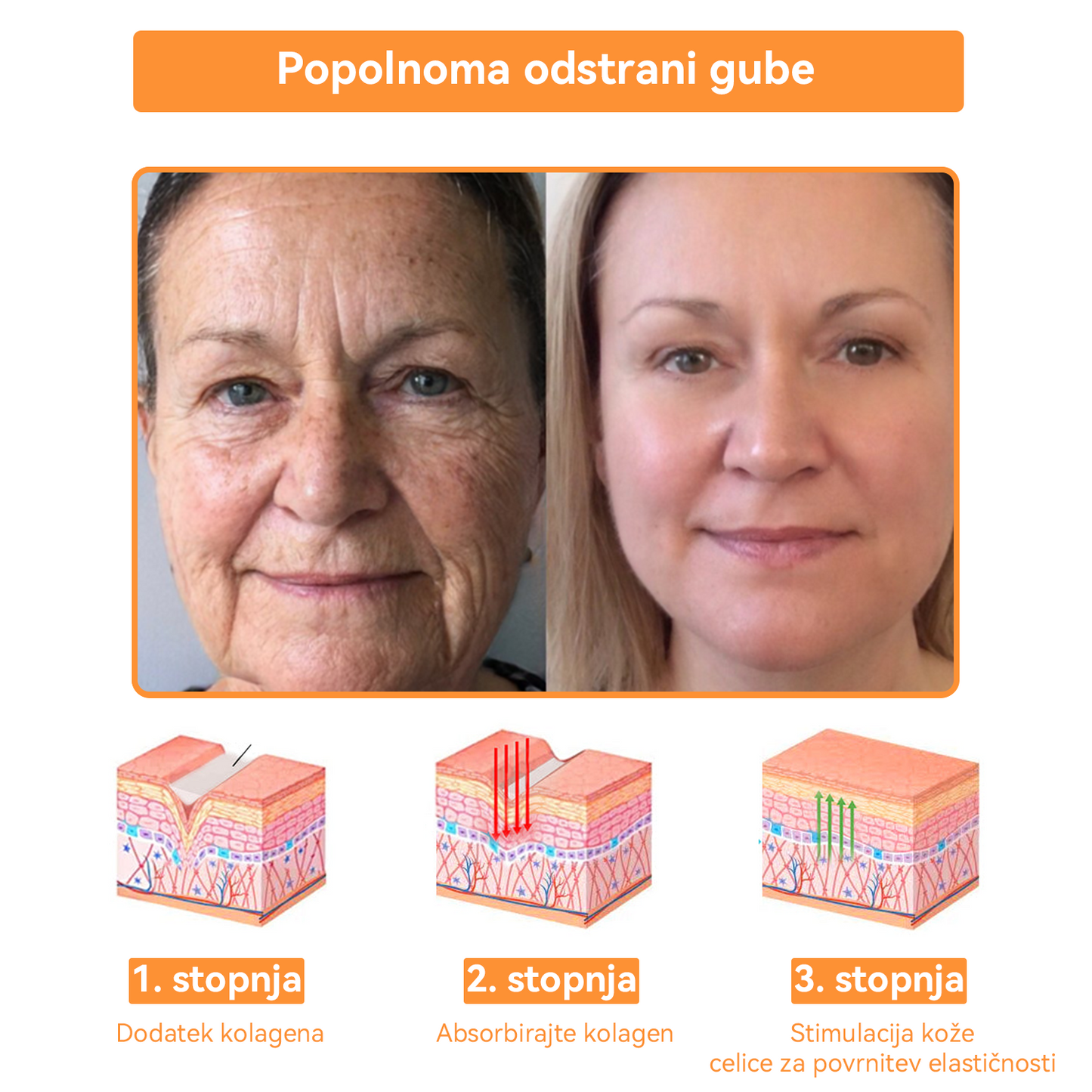 Dormorna™ 💧 Krema za nego kože celotnega telesa (👩‍⚕️priporočeno s strani Inštituta za dermatologijo)