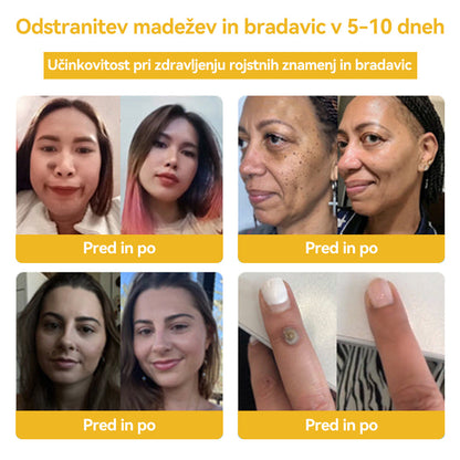 🍍𝑺𝒑𝒛𝒗™  Č𝒆𝒃𝒆𝒍𝒋𝒊 𝒔𝒕𝒓𝒖𝒑 𝑲𝒓𝒆𝒎𝒂 𝒛𝒂 𝒛𝒅𝒓𝒂𝒗𝒍𝒋𝒆𝒏𝒋𝒆 𝒌𝒓𝒆𝒕𝒆𝒏𝒋 𝒊𝒏 𝒃𝒓𝒂𝒅𝒂𝒗𝒊𝒄 ⚡⚡(🧑‍⚕️𝑺𝒑𝒆𝒄𝒊𝒂𝒍𝒊𝒔𝒕 𝑫𝒆𝒓𝒎𝒂𝒕𝒐𝒍𝒐𝒈𝒊𝒔𝒕 𝑹𝒆𝒄𝒐𝒎𝒎𝒆𝒏𝒅𝒂𝒕𝒊𝒐𝒏🔥🔥𝒁𝒂𝒅𝒏𝒋𝒂 𝒑𝒓𝒐𝒎𝒐𝒄𝒊𝒋𝒂 𝒅𝒂𝒍𝒚 80% 𝒐𝒇𝒇)