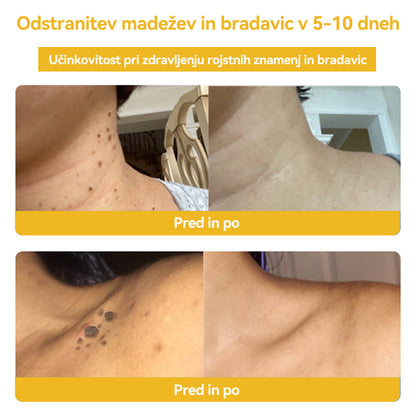 🍍𝑺𝒑𝒛𝒗™  Č𝒆𝒃𝒆𝒍𝒋𝒊 𝒔𝒕𝒓𝒖𝒑 𝑲𝒓𝒆𝒎𝒂 𝒛𝒂 𝒛𝒅𝒓𝒂𝒗𝒍𝒋𝒆𝒏𝒋𝒆 𝒌𝒓𝒆𝒕𝒆𝒏𝒋 𝒊𝒏 𝒃𝒓𝒂𝒅𝒂𝒗𝒊𝒄 ⚡⚡(🧑‍⚕️𝑺𝒑𝒆𝒄𝒊𝒂𝒍𝒊𝒔𝒕 𝑫𝒆𝒓𝒎𝒂𝒕𝒐𝒍𝒐𝒈𝒊𝒔𝒕 𝑹𝒆𝒄𝒐𝒎𝒎𝒆𝒏𝒅𝒂𝒕𝒊𝒐𝒏🔥🔥𝒁𝒂𝒅𝒏𝒋𝒂 𝒑𝒓𝒐𝒎𝒐𝒄𝒊𝒋𝒂 𝒅𝒂𝒍𝒚 80% 𝒐𝒇𝒇)