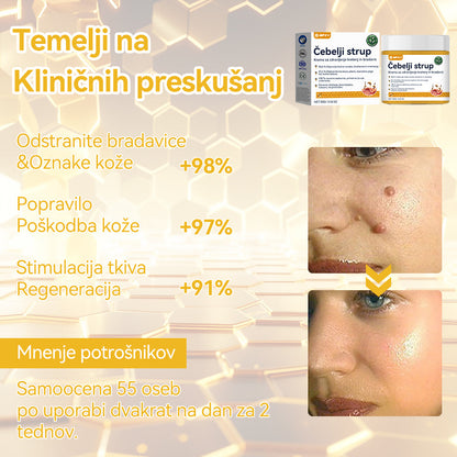 🍍𝑺𝒑𝒛𝒗™  Č𝒆𝒃𝒆𝒍𝒋𝒊 𝒔𝒕𝒓𝒖𝒑 𝑲𝒓𝒆𝒎𝒂 𝒛𝒂 𝒛𝒅𝒓𝒂𝒗𝒍𝒋𝒆𝒏𝒋𝒆 𝒌𝒓𝒆𝒕𝒆𝒏𝒋 𝒊𝒏 𝒃𝒓𝒂𝒅𝒂𝒗𝒊𝒄 ⚡⚡(🧑‍⚕️𝑺𝒑𝒆𝒄𝒊𝒂𝒍𝒊𝒔𝒕 𝑫𝒆𝒓𝒎𝒂𝒕𝒐𝒍𝒐𝒈𝒊𝒔𝒕 𝑹𝒆𝒄𝒐𝒎𝒎𝒆𝒏𝒅𝒂𝒕𝒊𝒐𝒏🔥🔥𝒁𝒂𝒅𝒏𝒋𝒂 𝒑𝒓𝒐𝒎𝒐𝒄𝒊𝒋𝒂 𝒅𝒂𝒍𝒚 80% 𝒐𝒇𝒇)