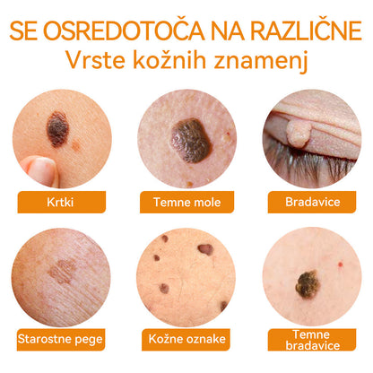 🍓🍓𝐕𝐬𝐨𝐱𝐚™ Č𝑒𝑏𝑒𝑙𝑗𝑖 𝑠𝑡𝑟𝑢𝑝 𝐾𝑟𝑒𝑚𝑎 𝑧𝑎 𝑜𝑑𝑠𝑡𝑟𝑎𝑛𝑗𝑒𝑣𝑎𝑛𝑗𝑒 𝑏𝑟𝑎𝑑𝑎𝑣𝑖𝑐 𝑖𝑛 𝑘𝑟𝑒𝑡𝑒𝑛𝑗( 👨‍⚕𝐴𝐴𝐷 𝑃𝑅𝐼𝑃𝑂𝑅𝑂Č𝐴)🐝🐝 (🔥𝑧𝑎𝑑𝑛𝑗𝑖 𝑑𝑎𝑛 𝑝𝑟𝑜𝑚𝑜𝑐𝑖𝑗𝑒 80% 𝑝𝑜𝑝𝑢𝑠𝑡)🔥💥