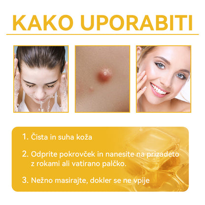 🍍𝑺𝒑𝒛𝒗™  Č𝒆𝒃𝒆𝒍𝒋𝒊 𝒔𝒕𝒓𝒖𝒑 𝑲𝒓𝒆𝒎𝒂 𝒛𝒂 𝒛𝒅𝒓𝒂𝒗𝒍𝒋𝒆𝒏𝒋𝒆 𝒌𝒓𝒆𝒕𝒆𝒏𝒋 𝒊𝒏 𝒃𝒓𝒂𝒅𝒂𝒗𝒊𝒄 ⚡⚡(🧑‍⚕️𝑺𝒑𝒆𝒄𝒊𝒂𝒍𝒊𝒔𝒕 𝑫𝒆𝒓𝒎𝒂𝒕𝒐𝒍𝒐𝒈𝒊𝒔𝒕 𝑹𝒆𝒄𝒐𝒎𝒎𝒆𝒏𝒅𝒂𝒕𝒊𝒐𝒏🔥🔥𝒁𝒂𝒅𝒏𝒋𝒂 𝒑𝒓𝒐𝒎𝒐𝒄𝒊𝒋𝒂 𝒅𝒂𝒍𝒚 80% 𝒐𝒇𝒇)