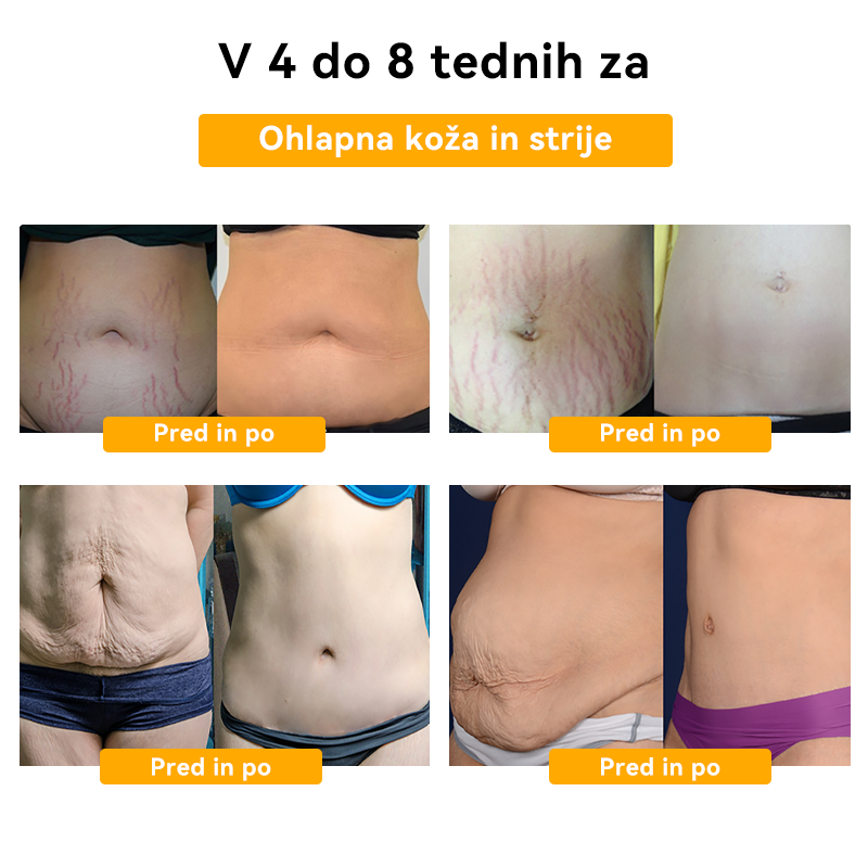 👑👑𝑭𝑹𝑶𝑷𝑼𝑵™ Č𝐞𝐛𝐞𝐥𝐣𝐢 𝐒𝐭𝐫𝐮𝐩 𝐇𝐮𝐣š𝐚𝐧𝐣𝐞 𝐊𝐫𝐞𝐦𝐚⭐ (𝒁𝒂 𝒗𝒔𝒆 𝒍𝒊𝒎𝒇𝒏𝒆 𝒕𝒆ž𝒂𝒗𝒆 𝒊𝒏 𝒅𝒆𝒃𝒆𝒍𝒐𝒔𝒕)