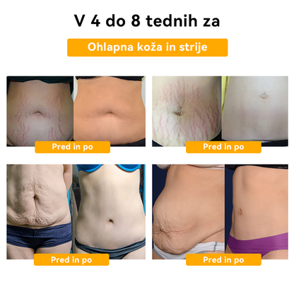 👑👑𝑭𝑹𝑶𝑷𝑼𝑵™ Č𝐞𝐛𝐞𝐥𝐣𝐢 𝐒𝐭𝐫𝐮𝐩 𝐇𝐮𝐣š𝐚𝐧𝐣𝐞 𝐊𝐫𝐞𝐦𝐚⭐ (𝒁𝒂 𝒗𝒔𝒆 𝒍𝒊𝒎𝒇𝒏𝒆 𝒕𝒆ž𝒂𝒗𝒆 𝒊𝒏 𝒅𝒆𝒃𝒆𝒍𝒐𝒔𝒕)