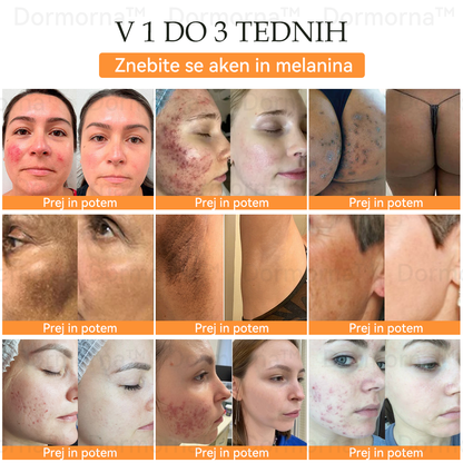 ✅Uradna trgovina:𝐷𝑜𝑟𝑚𝑜𝑟𝑛𝑎™💎Č𝑒𝑏𝑒𝑙𝑗𝑖 𝑆𝑡𝑟𝑢𝑝 𝑃𝑜𝑝𝑜𝑙𝑛𝑎 𝑃𝑜𝑝𝑟𝑎𝑣𝑖𝑙𝑜 𝑍𝑑𝑟𝑎𝑣𝑙𝑗𝑒𝑛𝑗𝑒 𝑆𝑚𝑒𝑡𝑎𝑛𝑎 (👩‍⚕️👩‍⚕️𝐒𝐃𝐕𝐃 𝐩𝐫𝐢𝐩𝐨𝐫𝐨č𝐞𝐧𝐨)-𝑂𝑑𝑠𝑡𝑟𝑎𝑛𝑖𝑡𝑒 𝑚𝑎𝑑𝑒ž𝑒, 𝑏𝑟𝑎𝑑𝑎𝑣𝑖𝑐𝑒, ℎ𝑖𝑝𝑒𝑟𝑝𝑖𝑔𝑚𝑒𝑛𝑡𝑎𝑐𝑖𝑗𝑜, 𝑠𝑡𝑎𝑟𝑜𝑠𝑡𝑛𝑒 𝑝𝑒𝑔𝑒, 𝑎𝑘𝑛𝑒, 𝑏𝑟𝑎𝑧𝑔𝑜𝑡𝑖𝑛𝑒 🥇🥇🥇