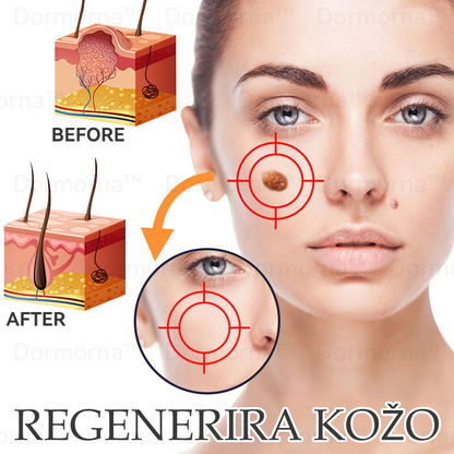 ✅Uradna trgovina:𝐷𝑜𝑟𝑚𝑜𝑟𝑛𝑎™💎Č𝑒𝑏𝑒𝑙𝑗𝑖 𝑆𝑡𝑟𝑢𝑝 𝑃𝑜𝑝𝑜𝑙𝑛𝑎 𝑃𝑜𝑝𝑟𝑎𝑣𝑖𝑙𝑜 𝑍𝑑𝑟𝑎𝑣𝑙𝑗𝑒𝑛𝑗𝑒 𝑆𝑚𝑒𝑡𝑎𝑛𝑎 (👩‍⚕️👩‍⚕️𝐒𝐃𝐕𝐃 𝐩𝐫𝐢𝐩𝐨𝐫𝐨č𝐞𝐧𝐨)-𝑂𝑑𝑠𝑡𝑟𝑎𝑛𝑖𝑡𝑒 𝑚𝑎𝑑𝑒ž𝑒, 𝑏𝑟𝑎𝑑𝑎𝑣𝑖𝑐𝑒, ℎ𝑖𝑝𝑒𝑟𝑝𝑖𝑔𝑚𝑒𝑛𝑡𝑎𝑐𝑖𝑗𝑜, 𝑠𝑡𝑎𝑟𝑜𝑠𝑡𝑛𝑒 𝑝𝑒𝑔𝑒, 𝑎𝑘𝑛𝑒, 𝑏𝑟𝑎𝑧𝑔𝑜𝑡𝑖𝑛𝑒 🥇🥇🥇