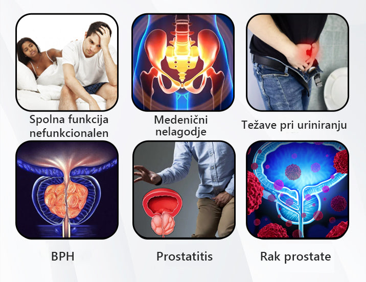 Poslovite se od težav s prostato💎𝐋𝐄𝐅𝐔𝐍𝐓™  𝐢𝐧𝐡𝐚𝐥𝐚𝐜𝐢𝐣𝐬𝐤𝐚 𝐩𝐚𝐥𝐢𝐜𝐚 𝐳 𝐦𝐞𝐝𝐨𝐦🍀(Hitro in dolgotrajno delovanje)