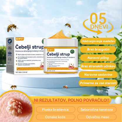 🍍𝑺𝒑𝒛𝒗™  Č𝒆𝒃𝒆𝒍𝒋𝒊 𝒔𝒕𝒓𝒖𝒑 𝑲𝒓𝒆𝒎𝒂 𝒛𝒂 𝒛𝒅𝒓𝒂𝒗𝒍𝒋𝒆𝒏𝒋𝒆 𝒌𝒓𝒆𝒕𝒆𝒏𝒋 𝒊𝒏 𝒃𝒓𝒂𝒅𝒂𝒗𝒊𝒄 ⚡⚡(🧑‍⚕️𝑺𝒑𝒆𝒄𝒊𝒂𝒍𝒊𝒔𝒕 𝑫𝒆𝒓𝒎𝒂𝒕𝒐𝒍𝒐𝒈𝒊𝒔𝒕 𝑹𝒆𝒄𝒐𝒎𝒎𝒆𝒏𝒅𝒂𝒕𝒊𝒐𝒏🔥🔥𝒁𝒂𝒅𝒏𝒋𝒂 𝒑𝒓𝒐𝒎𝒐𝒄𝒊𝒋𝒂 𝒅𝒂𝒍𝒚 80% 𝒐𝒇𝒇)
