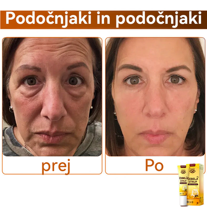 Oyikey™💥💥Čebelji strup Krema za oči Wake Up Priporoča dermatolog.