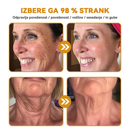 (🎁 Ekskluzivna posebna ponudba - 70 % popust - ne zamudite!) Spzv™💎 𝐁𝐎𝐓𝐎𝐗 Strije proti staranju z medenim strupom