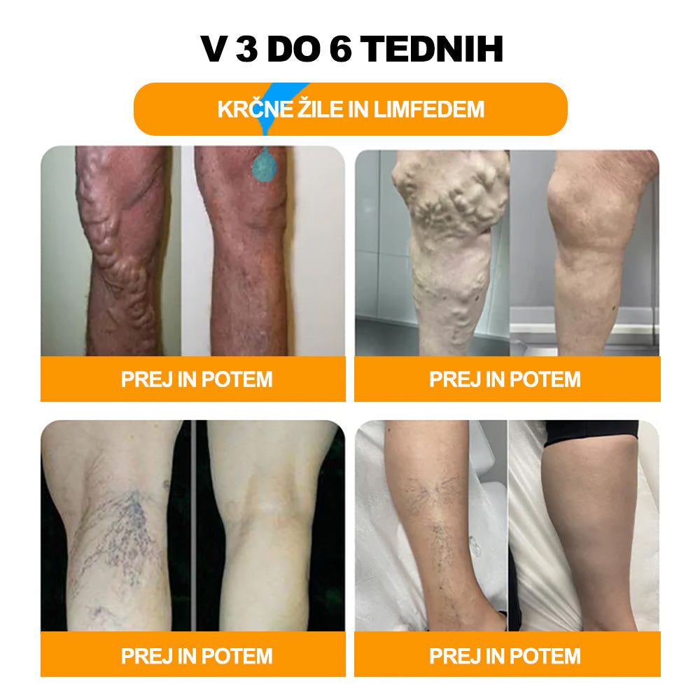 💎📦Zadnji dan, da bi dobili 70% OFF: Tnnedey® 𝑽č𝒆𝒍í 𝒋𝒆𝒅 𝒂 30 𝒃𝒚𝒍𝒊𝒏𝒏é 𝒅𝒆𝒕𝒐𝒙𝒊𝒌𝒂č𝒏é 𝒈𝒖ľôč𝒌𝒚 𝒏𝒂 𝒌ú𝒑𝒆ľ 𝒏ô𝒉 𝒑𝒓𝒆 𝒕𝒗𝒂𝒓𝒐𝒗𝒂𝒏𝒊𝒆 𝒕𝒆𝒍𝒂- Priporoča Ameriška limfna akademija (ALA)🧀